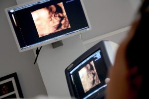 Jakie choroby może wykryć lekarz za pomocą ultrasonografii?